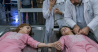 Doktor, otopsi masasında ölü olarak ilan edilen ikiz kızların zayıf kahkahalarını duyunca şoke oldu