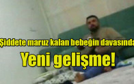 Şiddete maruz kalan bebeğin davasında Yeni gelişme!