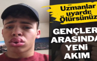 Gençlerin tehlikeli ‘evde estetik’ akımı