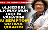 Ülkede ilk maymun çiçeği hastasını bulan Türk doktor
