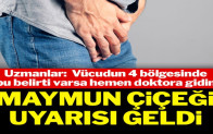 Vücudunuzun dört yerinden birinde bu belirti varsa doktora gidin