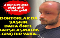 2 gün üst üste plaja gitti bu hale geldi