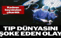 Kadının beyninden çıkarıldı: Tıp dünyasını şoke eden olay