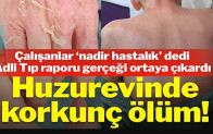 Huzurevinde korkunç ölüm! Adli Tıp raporu gerçeği ortaya çıkardı