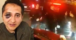 Avukat döven Cumhurbaşkanlığı korumalarına ne oldu? 