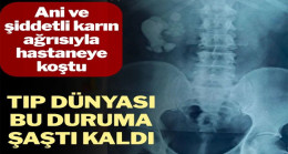 Doktorlar şaştı kaldı