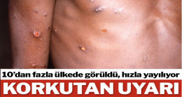 Virüs Yayılırken DSÖ’den korkutan uyarı