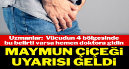 Vücudunuzun dört yerinden birinde bu belirti varsa doktora gidin