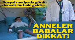 Sosyal medyada gördü, denedi, bu hale geldi