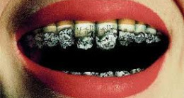 LİMONLU SU kullanırken KAÇINMANIZ GEREKEN 13 HATA