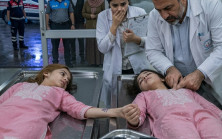 Doktor, otopsi masasında ölü olarak ilan edilen ikiz kızların zayıf kahkahalarını duyunca şoke oldu