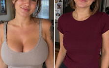 Yıllardır Çektiğim Ağrılar Bitti Ama Evliliğim O Gün Sona Ermeye Başladı