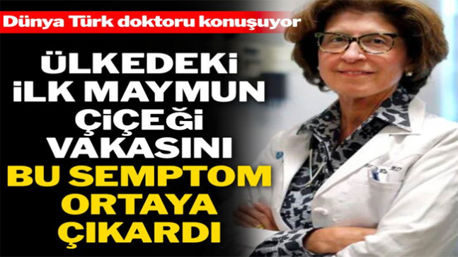 Ülkede ilk maymun çiçeği hastasını bulan Türk doktor