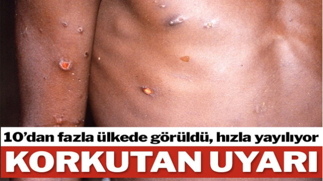 Virüs Yayılırken DSÖ’den korkutan uyarı