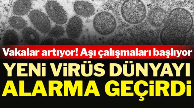 Maymun çiçeği virüsü dünyayı alarma geçirdi