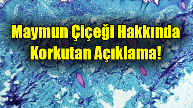 Maymun Çiçeği Hakkında Korkutan Açıklama!