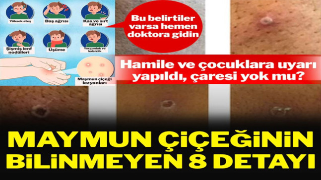 Maymun çiçeği virüsü hakkında bilmeniz gereken 8 şey: En çok kime bulaşıyor?