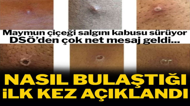 Nasıl bulaştığını duyurdular