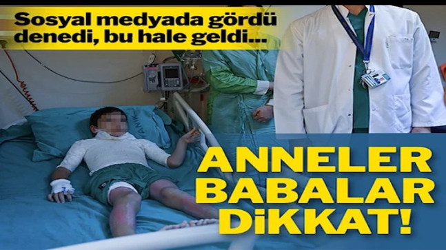 Sosyal medyada gördü, denedi, bu hale geldi