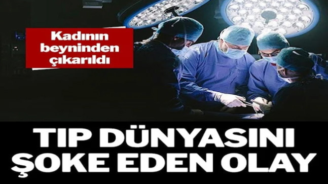 Kadının beyninden çıkarıldı: Tıp dünyasını şoke eden olay