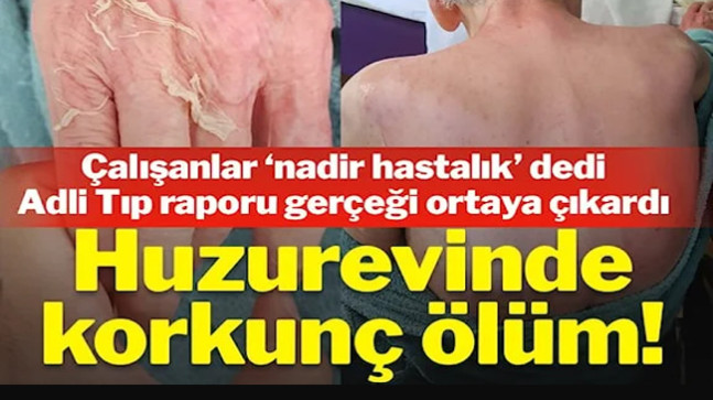 Huzurevinde korkunç ölüm! Adli Tıp raporu gerçeği ortaya çıkardı