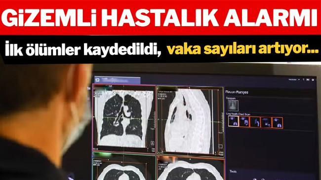 Gizemli hastalık ülkeyi alarma geçirdi: Vakalar artıyor…