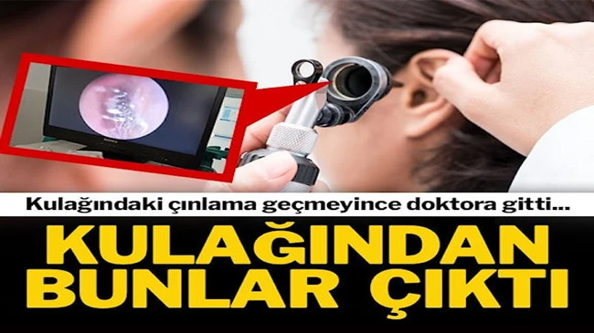 “Çınlama var” diye doktora gitti, bakın kulağından ne çıktı ?